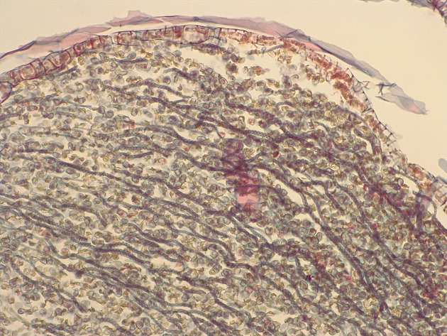 Liverwort Sporophyte Slides - Liverwort Sporophyte 03 200X
